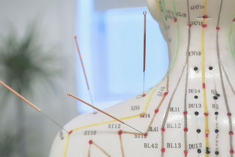 Agopuntura Lugano - Montagnola - Malcantone